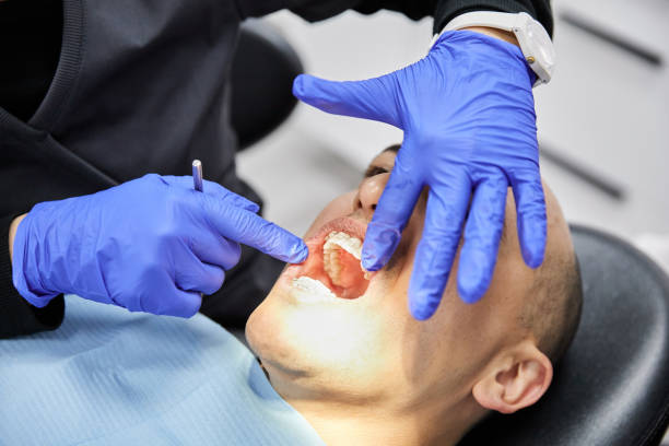 Best Emergency Tooth Extraction in Kirkland, WA